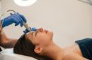 Mezoterapia mikroigłowa